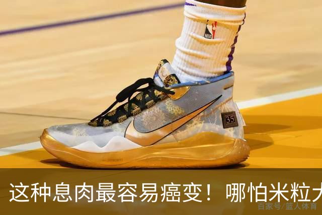 这种息肉最容易癌变！哪怕米粒大也要重视，现在切还来得及